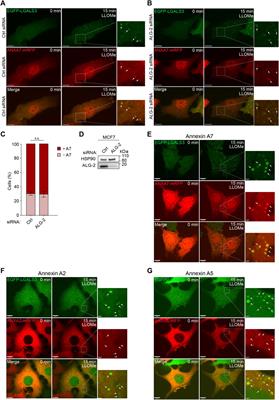 Annexin A7 mediates lysosome repair independently of ESCRT-III